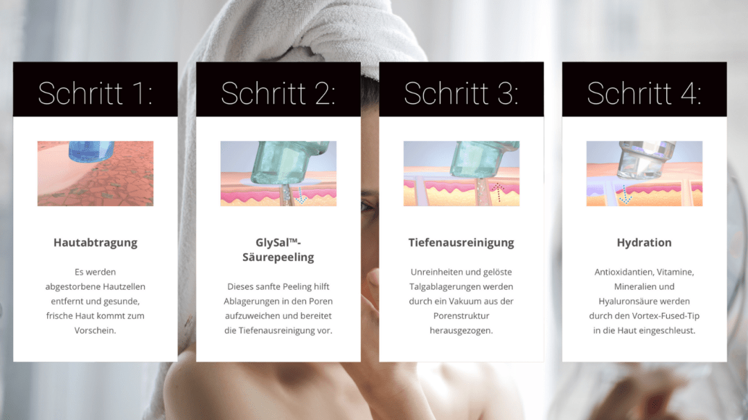 Die vier Schritte des Hydrafacial im Schema